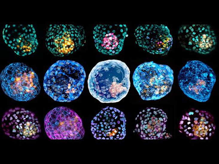 'First complete models' of a human embryo made in the lab